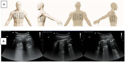 Screening for the causes of refractory hypoxemia in critically ill patients: A case report